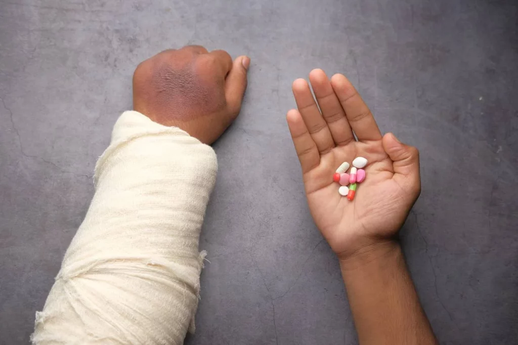 person with broken arm taking pills