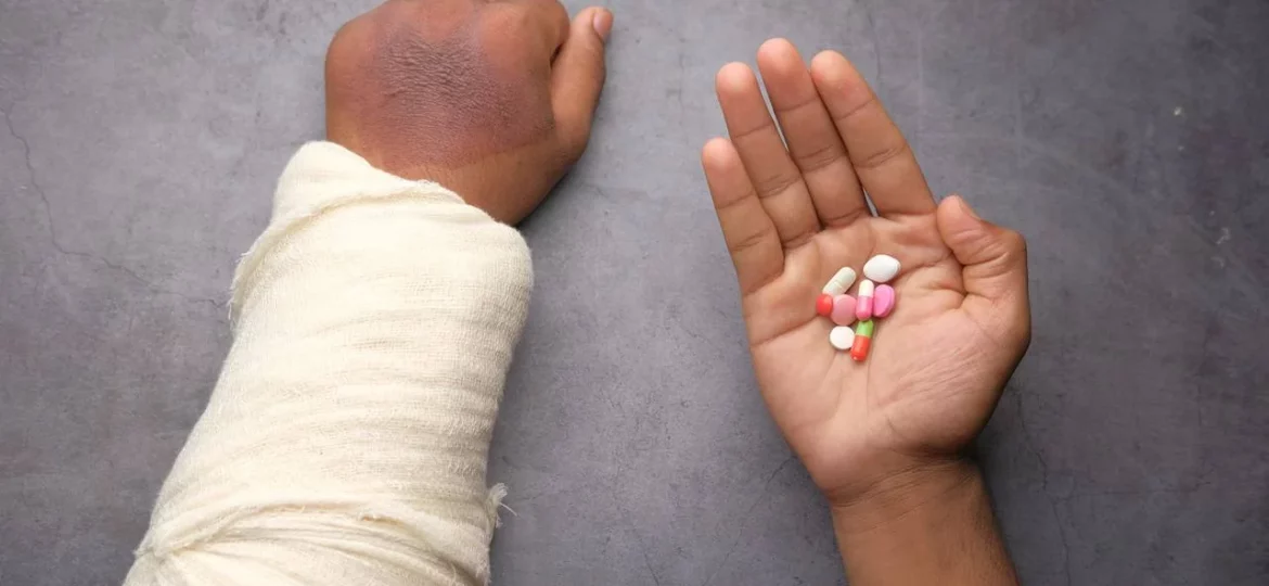 person with broken arm taking pills